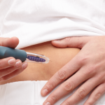 Ozonoterapia ernia lombare Roma
